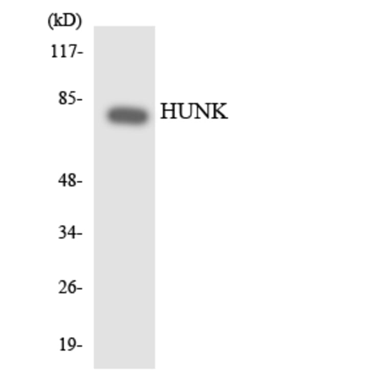 Western Blot - Anti-HUNK Antibody (R12-2906) - Antibodies.com