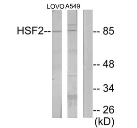 Western Blot - Anti-HSF2 Antibody (C10871) - Antibodies.com