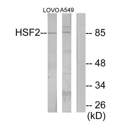 Western Blot - Anti-HSF2 Antibody (C10871) - Antibodies.com