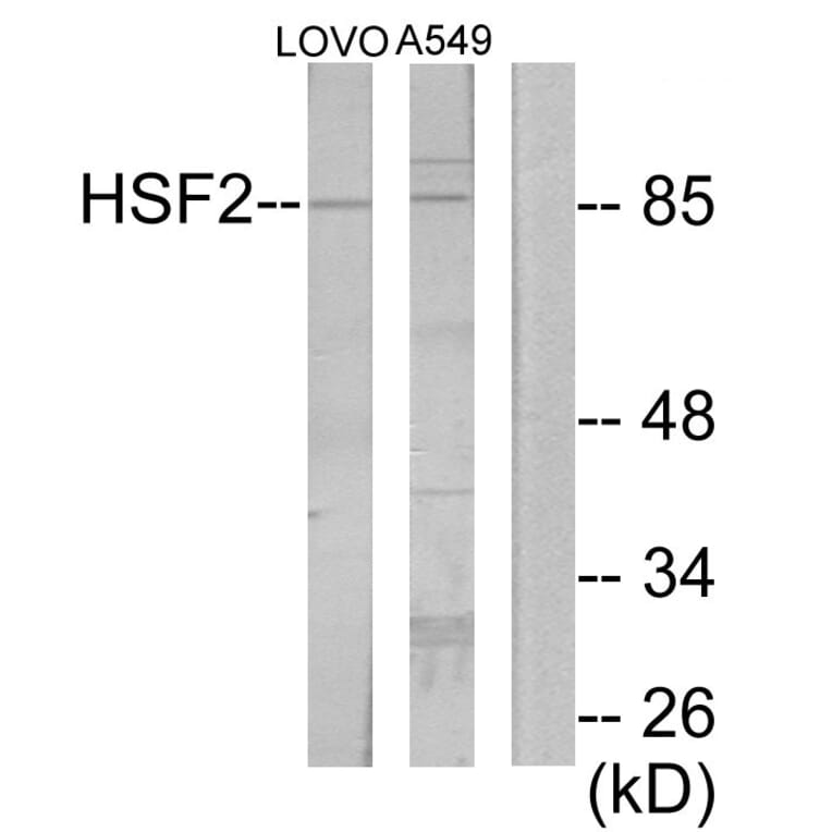 Western Blot - Anti-HSF2 Antibody (C10871) - Antibodies.com