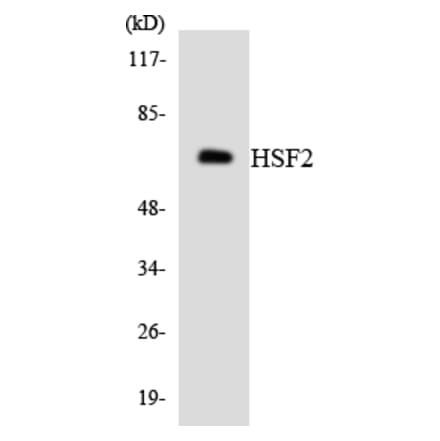 Western Blot - Anti-HSF2 Antibody (R12-2897) - Antibodies.com