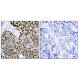 Immunohistochemistry - Anti-HSF1 Antibody (B7109) - Antibodies.com