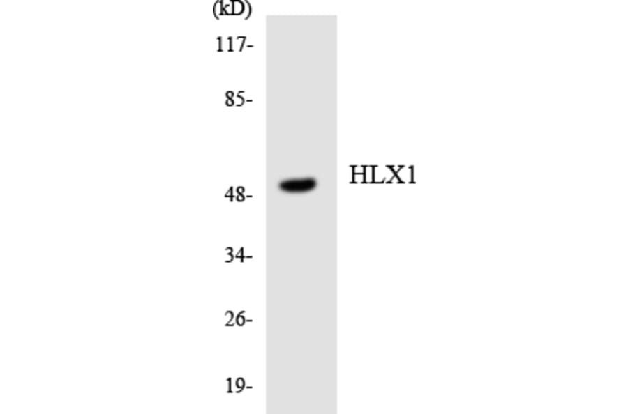 Western Blot - Anti-HLX1 Antibody (R12-2883) - Antibodies.com