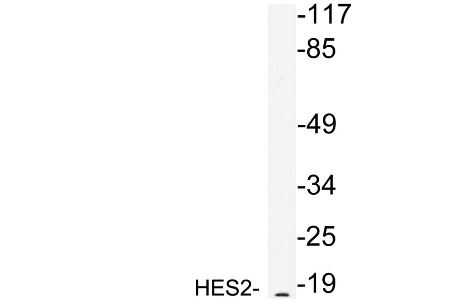 Western Blot - Anti-HES2 Antibody (R12-2178) - Antibodies.com