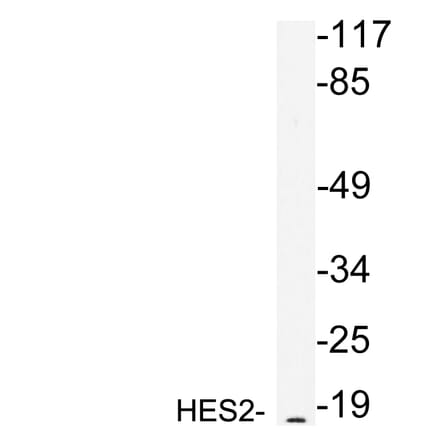 Western Blot - Anti-HES2 Antibody (R12-2178) - Antibodies.com