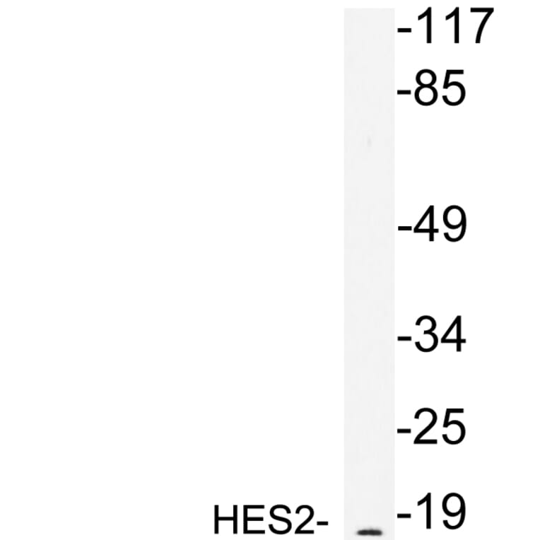 Western Blot - Anti-HES2 Antibody (R12-2178) - Antibodies.com
