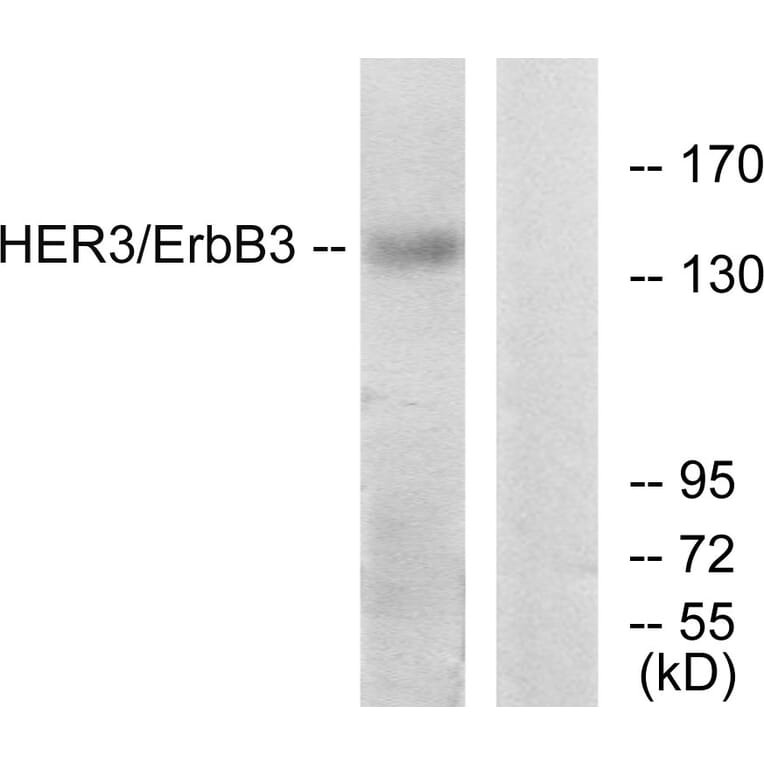 Western Blot - Anti-HER3 Antibody (B0946) - Antibodies.com