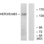 Western Blot - Anti-HER3 Antibody (B0946) - Antibodies.com