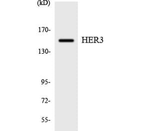 Western Blot - Anti-HER3 Antibody (R12-2873) - Antibodies.com