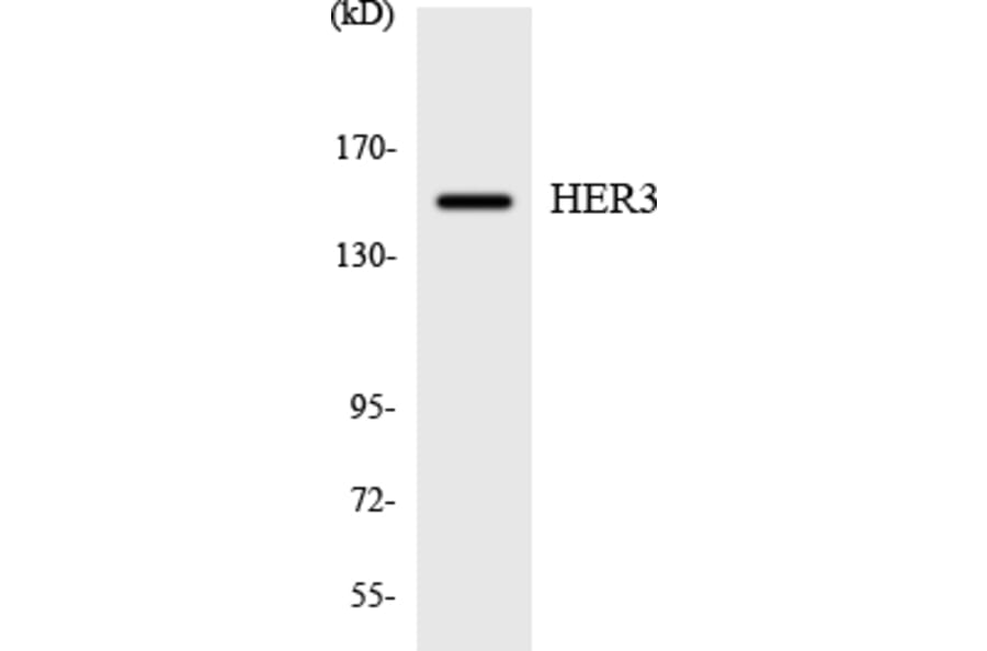 Western Blot - Anti-HER3 Antibody (R12-2873) - Antibodies.com