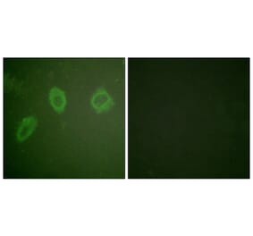Immunofluorescence - Anti-HER2 Antibody (B0918) - Antibodies.com