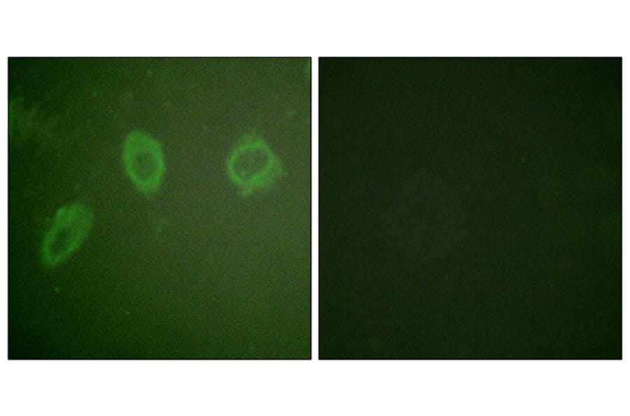 Immunofluorescence - Anti-HER2 Antibody (B0918) - Antibodies.com