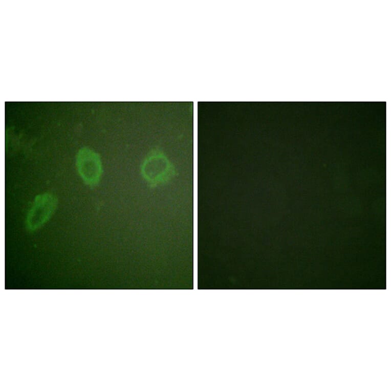 Immunofluorescence - Anti-HER2 Antibody (B0918) - Antibodies.com