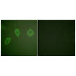 Immunofluorescence - Anti-HER2 Antibody (B0918) - Antibodies.com