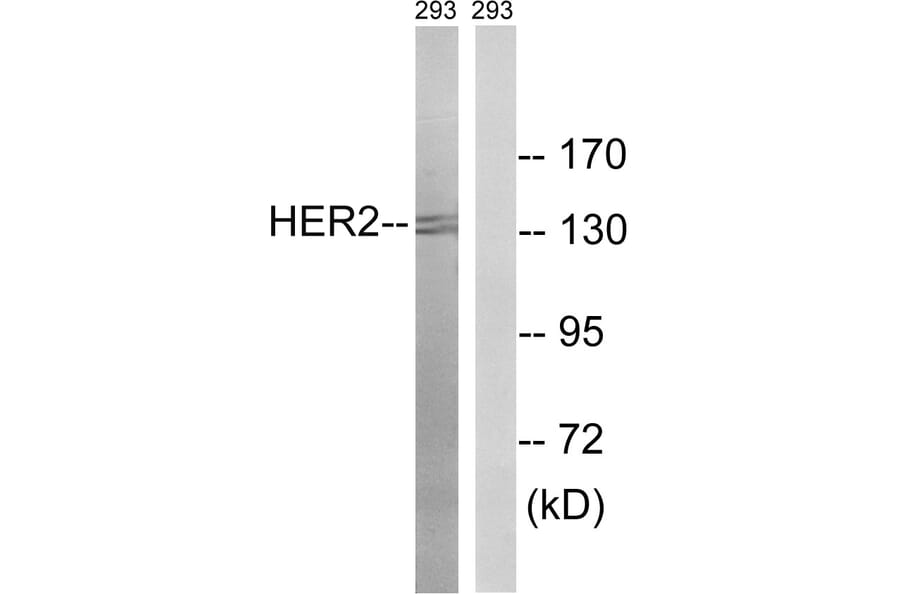 Western Blot - Anti-HER2 Antibody (B8039) - Antibodies.com