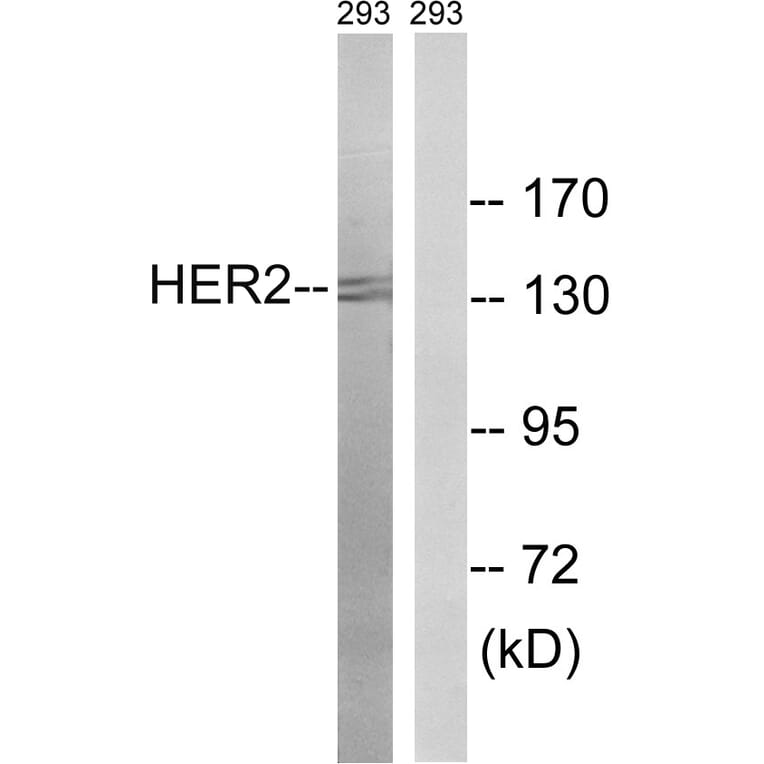Western Blot - Anti-HER2 Antibody (B8039) - Antibodies.com