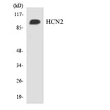 Western Blot - Anti-HCN2 Antibody (R12-2867) - Antibodies.com