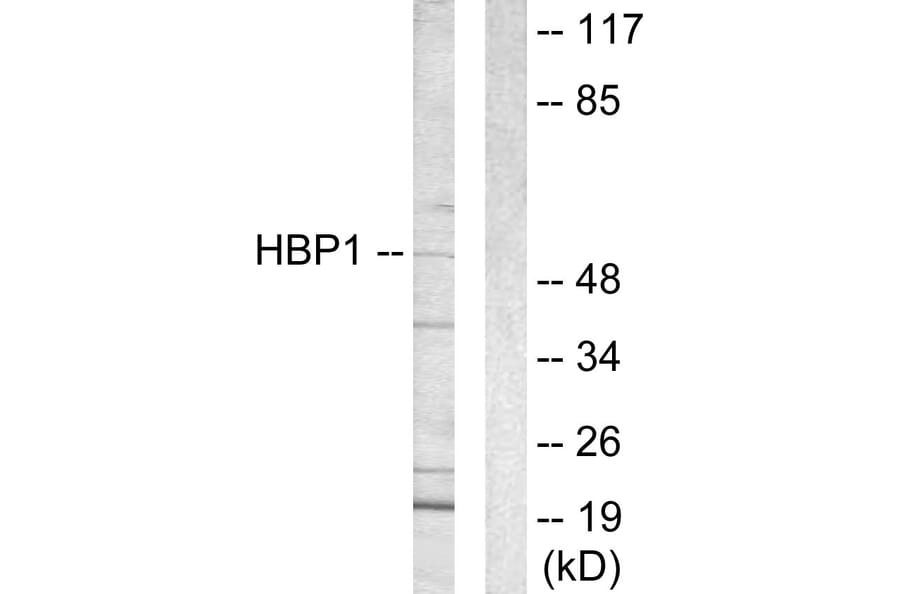 Western Blot - Anti-HBP1 Antibody (C10135) - Antibodies.com