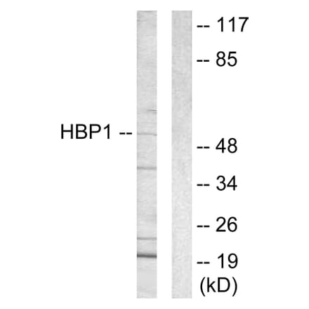 Western Blot - Anti-HBP1 Antibody (C10135) - Antibodies.com