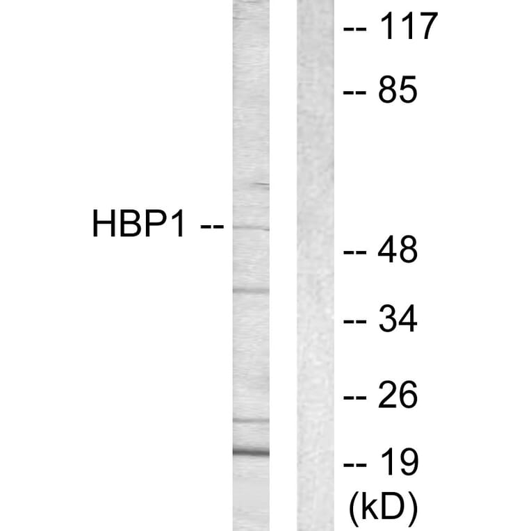 Western Blot - Anti-HBP1 Antibody (C10135) - Antibodies.com