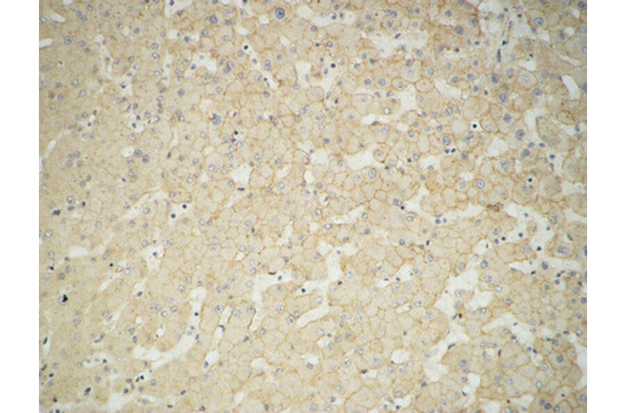 Immunohistochemistry - Anti-GUSB Antibody (C14735) - Antibodies.com