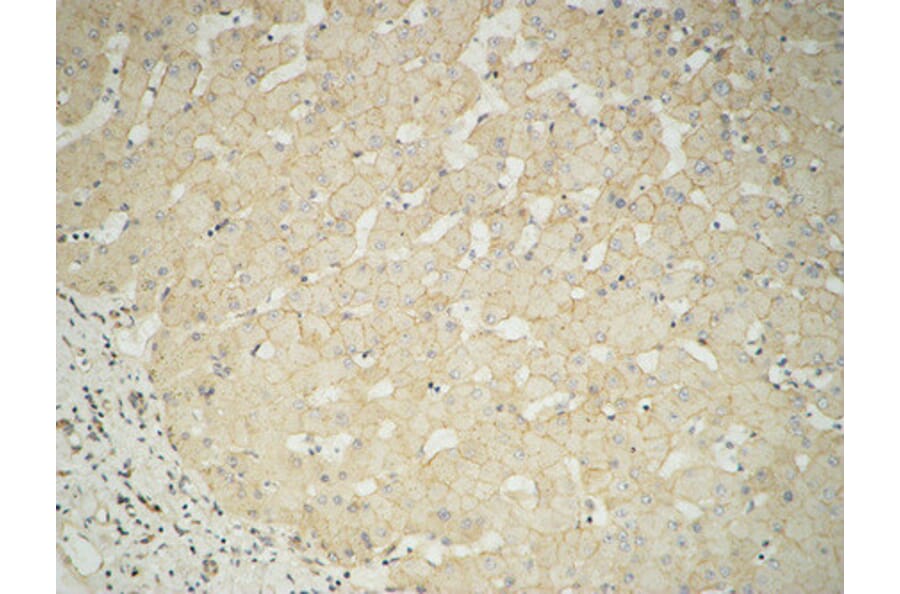 Immunohistochemistry - Anti-GUSB Antibody (C14735) - Antibodies.com