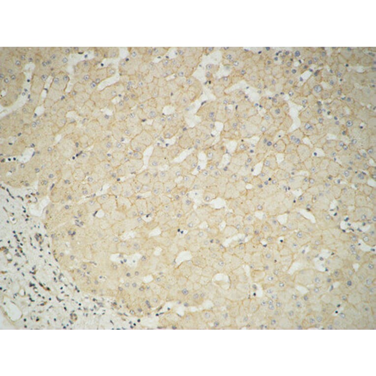 Immunohistochemistry - Anti-GUSB Antibody (C14735) - Antibodies.com