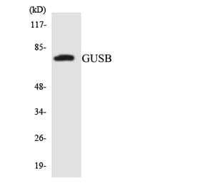 Western Blot - Anti-GUSB Antibody (R12-2863) - Antibodies.com