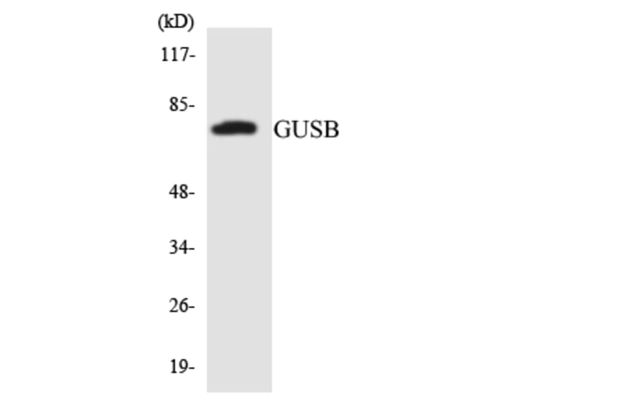 Western Blot - Anti-GUSB Antibody (R12-2863) - Antibodies.com