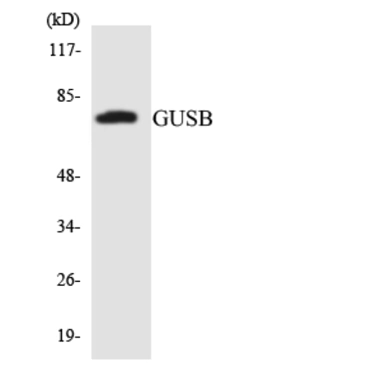 Western Blot - Anti-GUSB Antibody (R12-2863) - Antibodies.com