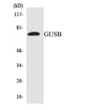 Western Blot - Anti-GUSB Antibody (R12-2863) - Antibodies.com