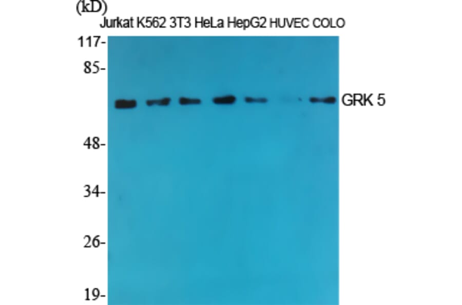 Western Blot - Anti-GRK5 Antibody (C10545) - Antibodies.com