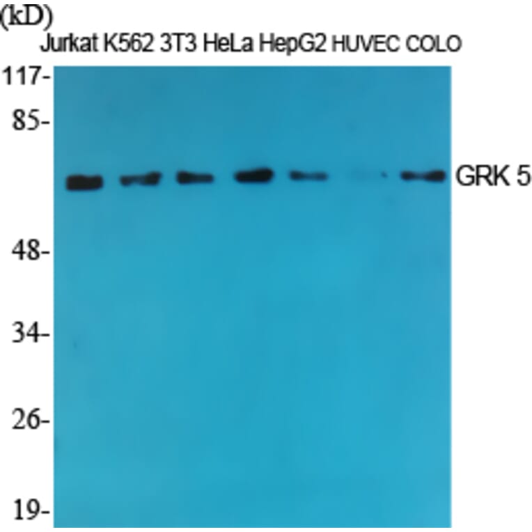 Western Blot - Anti-GRK5 Antibody (C10545) - Antibodies.com