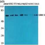 Western Blot - Anti-GRK5 Antibody (C10545) - Antibodies.com