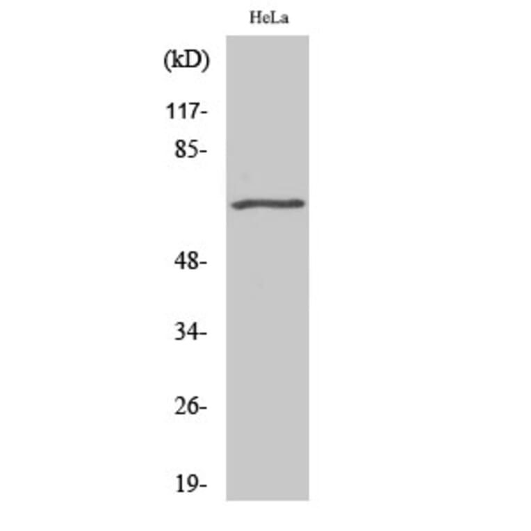 Western Blot - Anti-GRK5 Antibody (C10545) - Antibodies.com