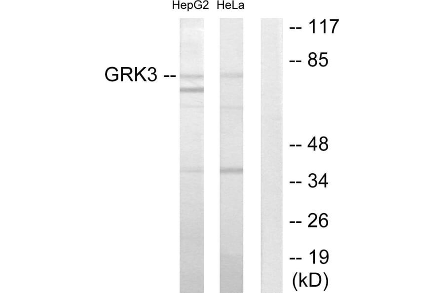 Western Blot - Anti-GRK3 Antibody (C10560) - Antibodies.com