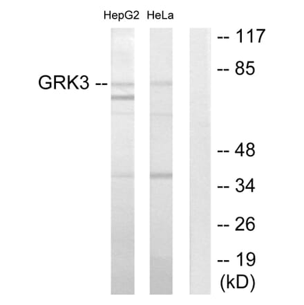 Western Blot - Anti-GRK3 Antibody (C10560) - Antibodies.com