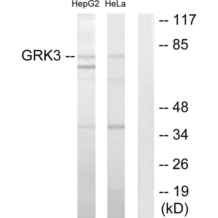 Western Blot - Anti-GRK3 Antibody (C10560) - Antibodies.com