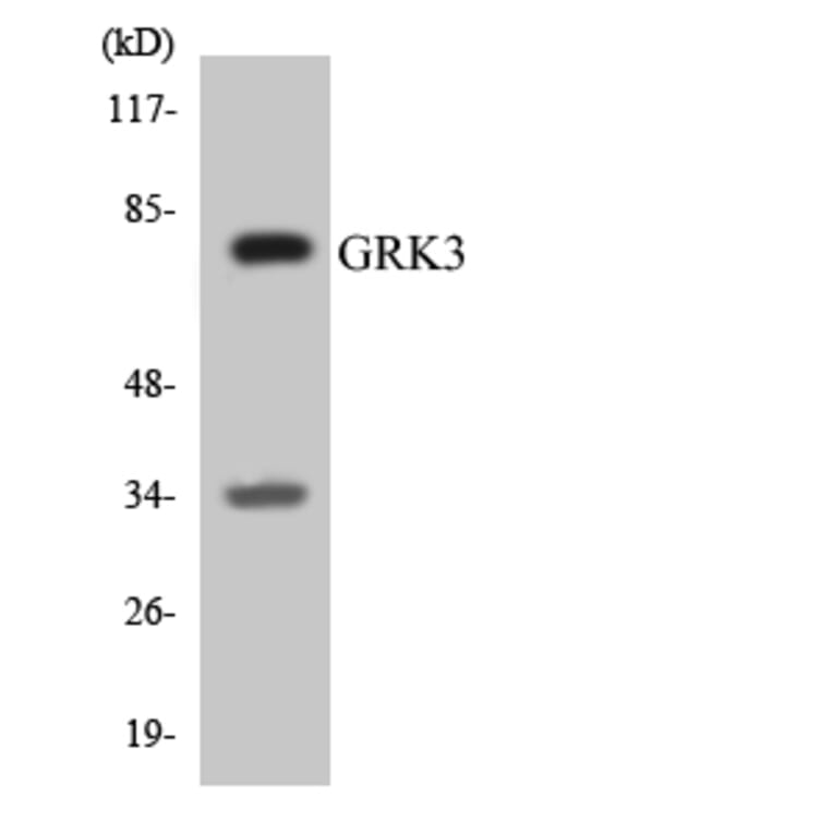 Western Blot - Anti-GRK3 Antibody (R12-2858) - Antibodies.com