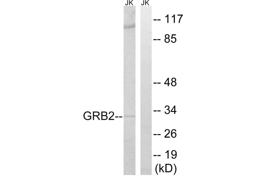 Western Blot - Anti-GRB2 Antibody (C15972) - Antibodies.com