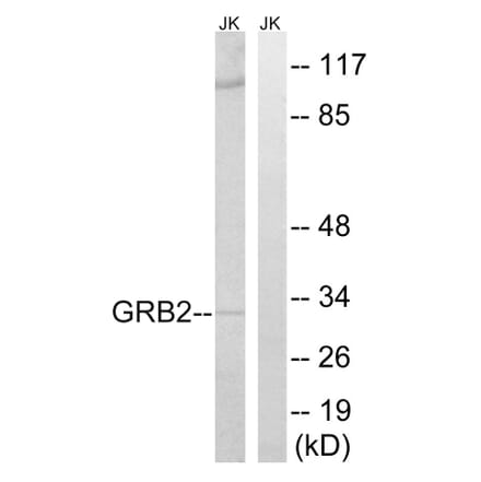 Western Blot - Anti-GRB2 Antibody (C15972) - Antibodies.com