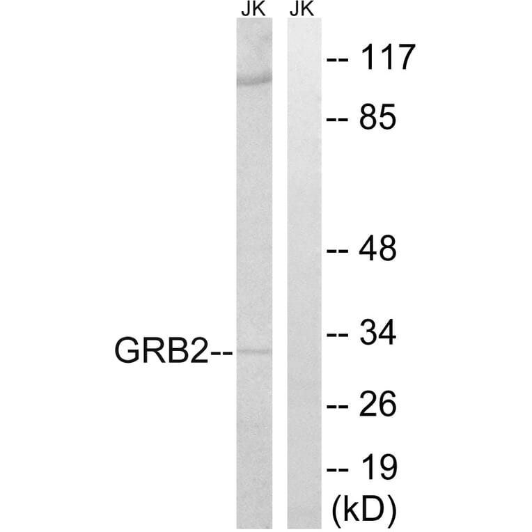 Western Blot - Anti-GRB2 Antibody (C15972) - Antibodies.com