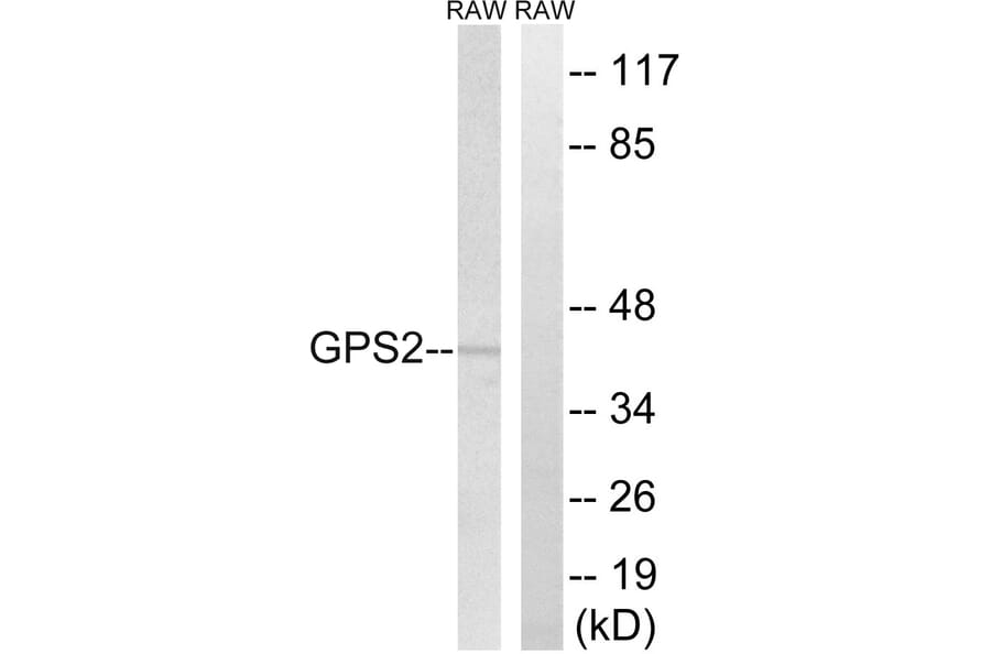 Western Blot - Anti-GPS2 Antibody (C15826) - Antibodies.com