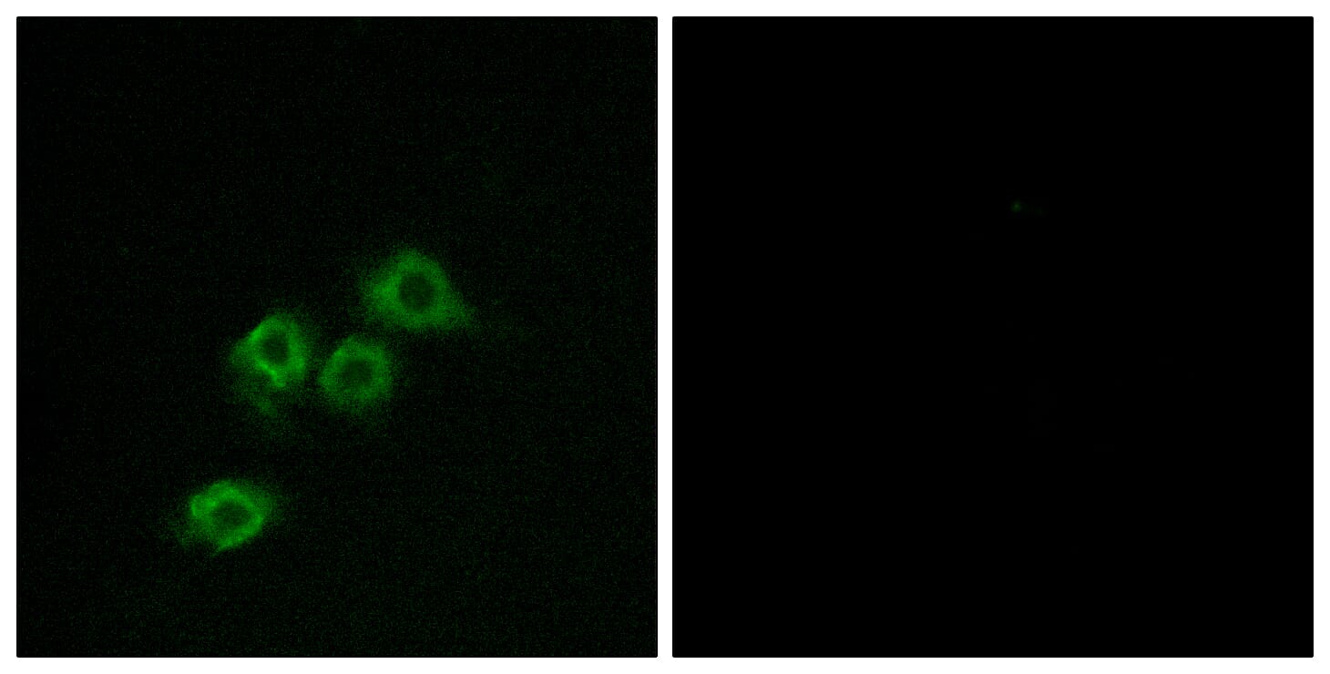 Immunofluorescence analysis of MCF7 cells using Anti-GPR1 Antibody. The right hand panel represents a negative control, where the antibody was pre-incubated with the immunising peptide.