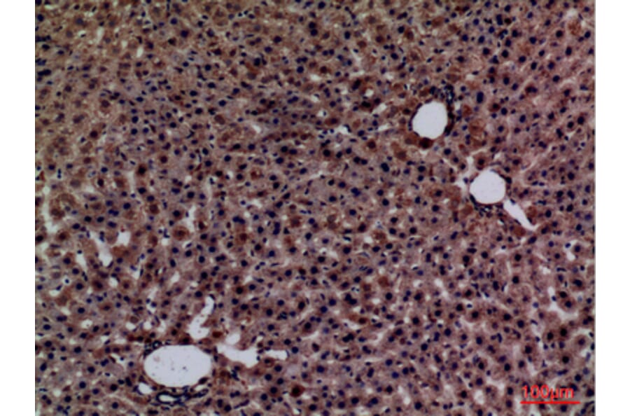 Immunohistochemistry - Anti-GPC3 Antibody (C30165) - Antibodies.com