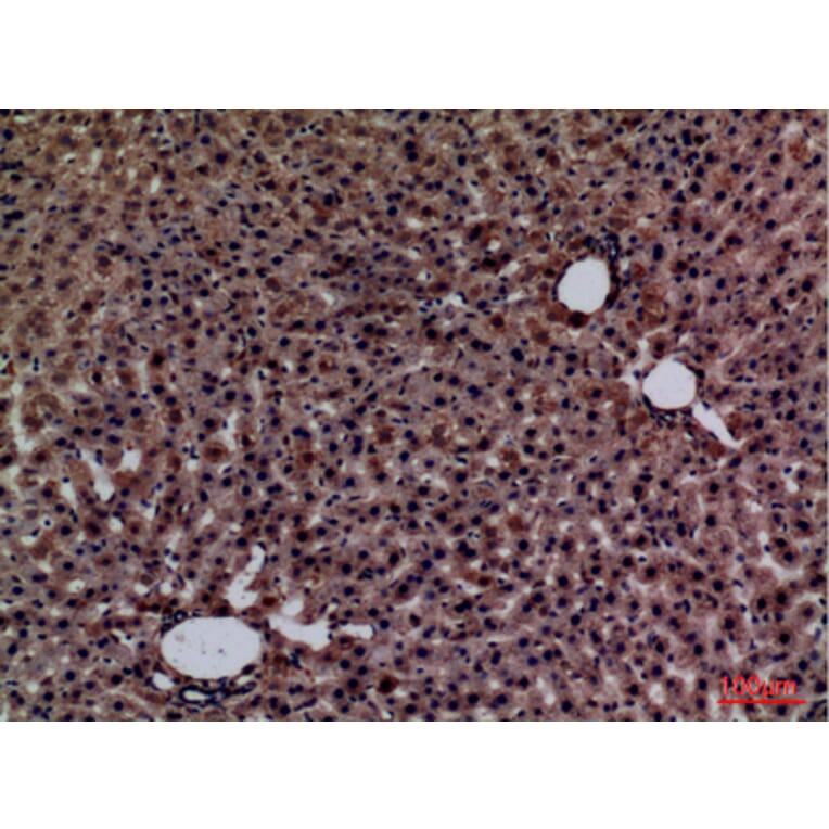 Immunohistochemistry - Anti-GPC3 Antibody (C30165) - Antibodies.com