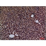 Immunohistochemistry - Anti-GPC3 Antibody (C30165) - Antibodies.com