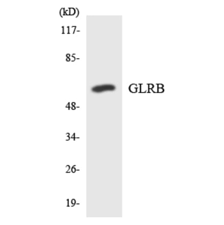 Western Blot - Anti-GLRB Antibody (R12-2816) - Antibodies.com