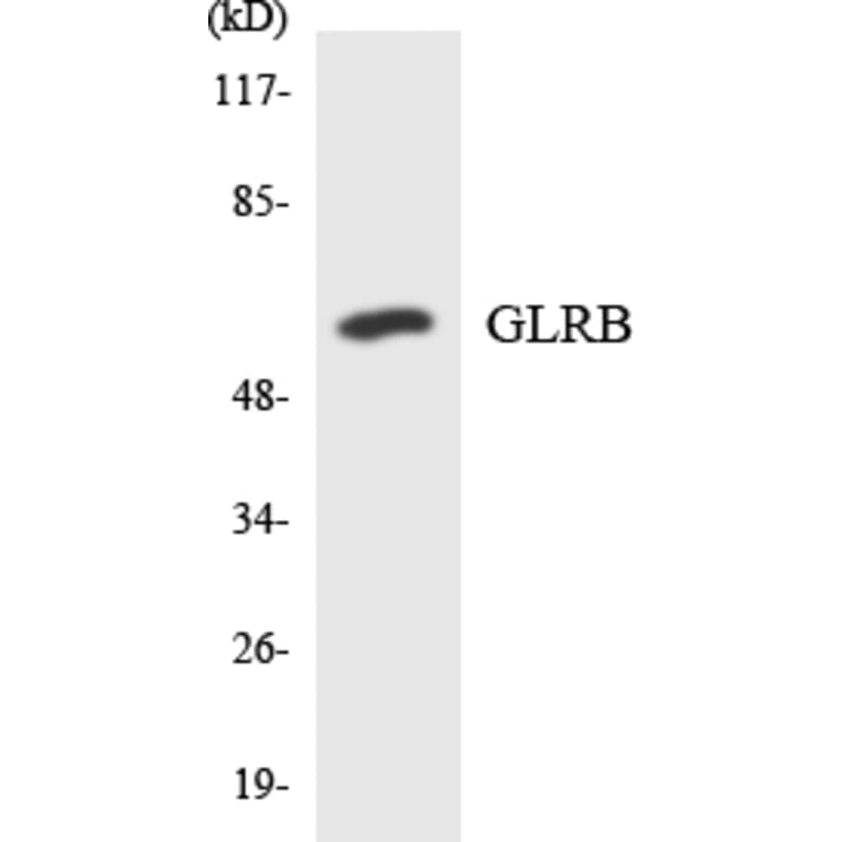 Western Blot - Anti-GLRB Antibody (R12-2816) - Antibodies.com