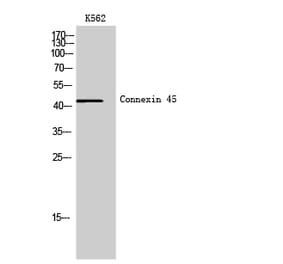 Western Blot - Anti-GJC1 Antibody (C15880) - Antibodies.com